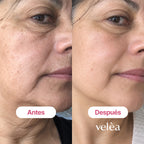 Velèa Pink Vitamin Serum energizante con PDRN y vitamina B12