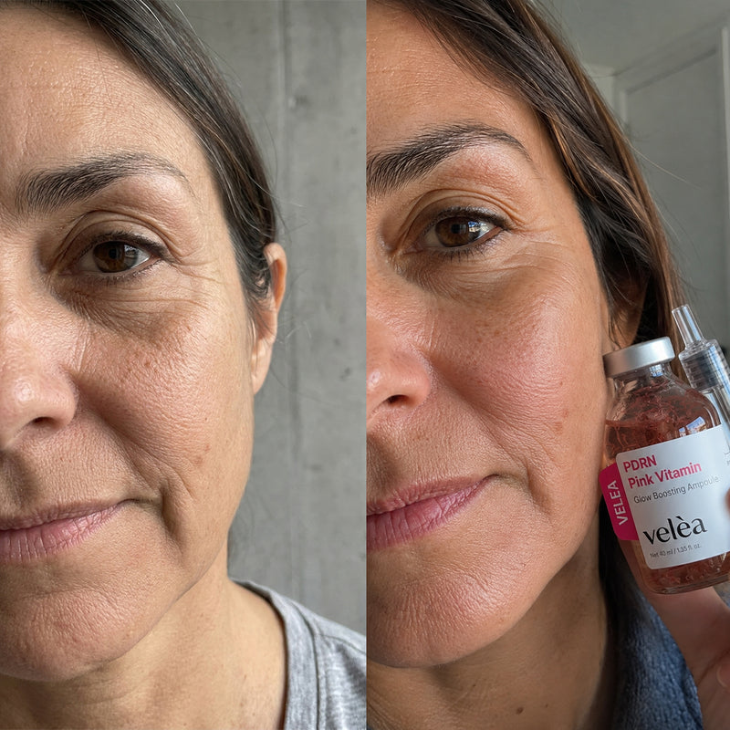 Antes y después de Pink Vitamin